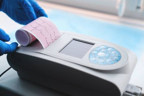 Electrocardiograma